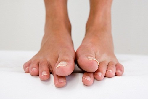 Судороги пальцев ног причина и что делать